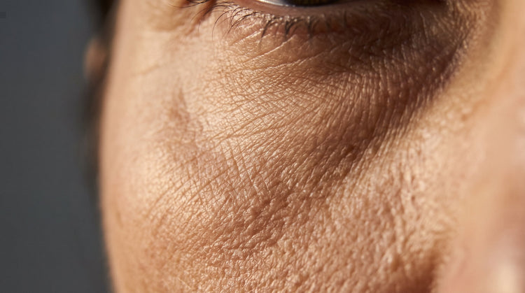 Eyebags: 7 Things You Should Know About Sleep, Ageing and Stress