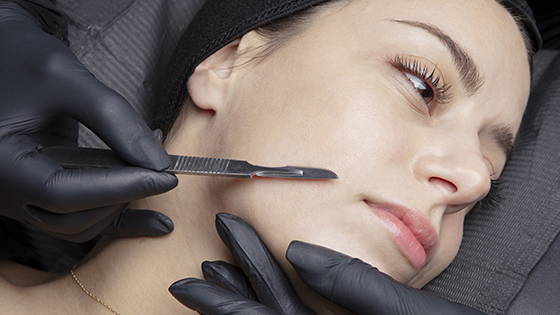 Dermaplaning! The ultimate exfoliation treatment.