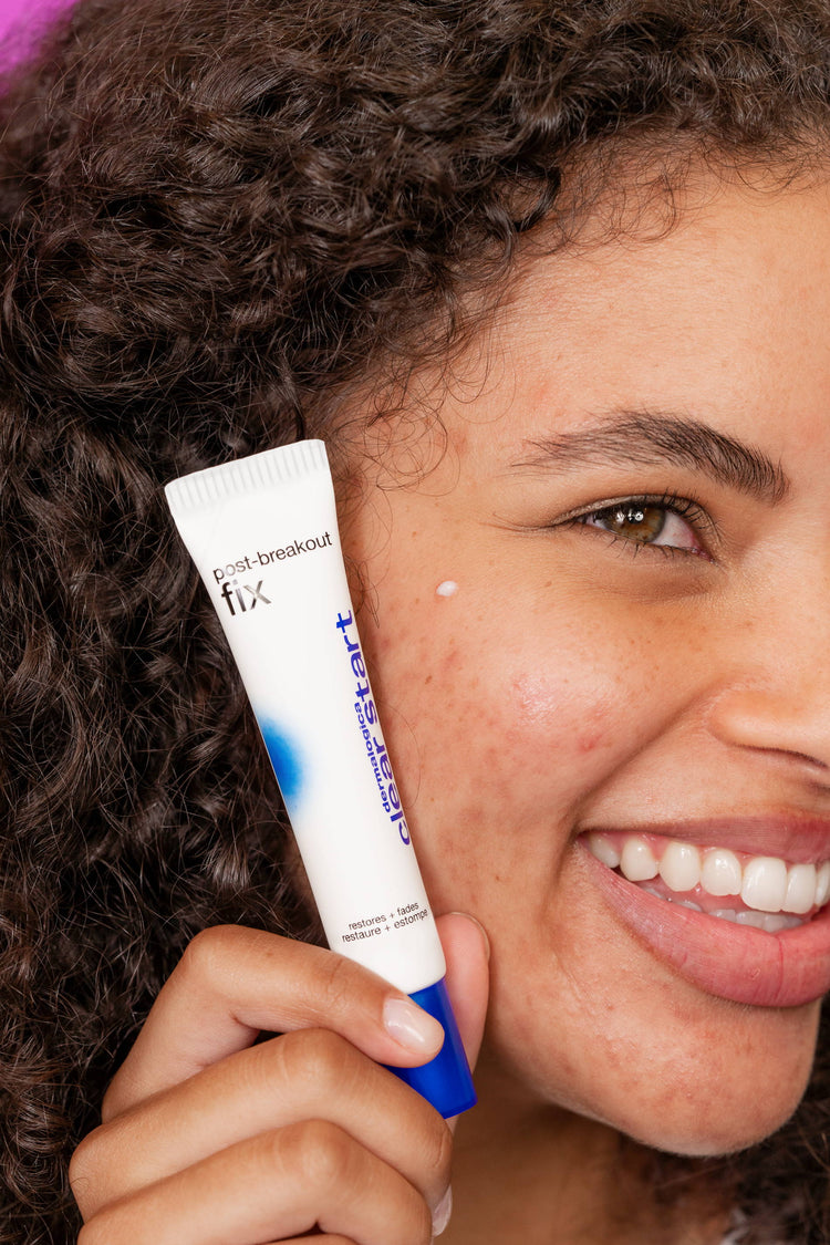 NEW! Dermalogica Post-Breakout Fix