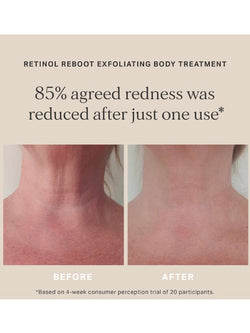 Alpha-H Retinol Reboot Exfoliating Body Treatment