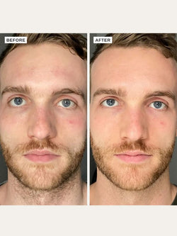 Alpha-H Vitamin B Serum with 5% Niacinamide