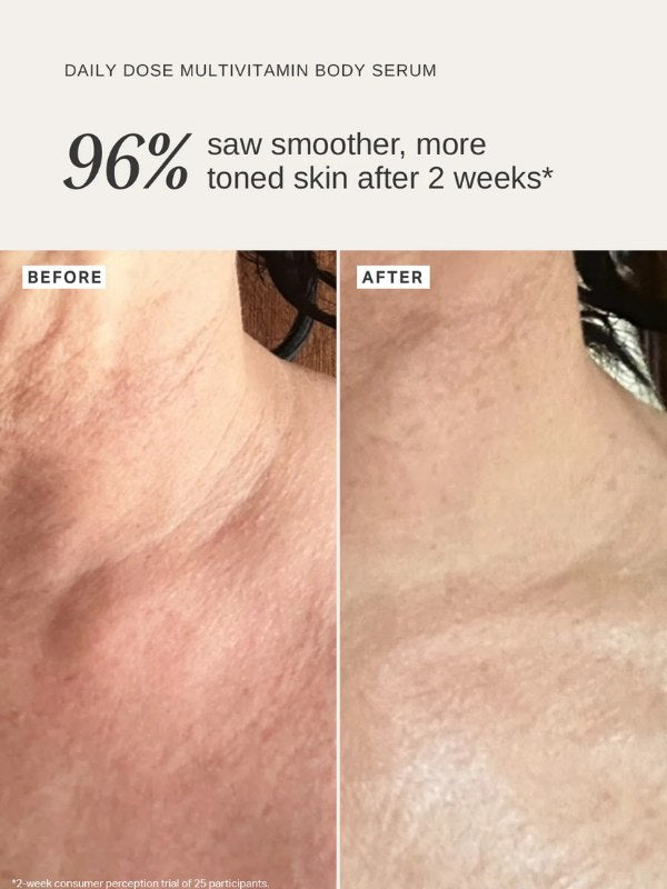 Alpha-H Daily Dose Multivitamin Body Serum