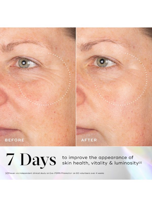 Medik8 Exo-PDRN Prismatic+ 30ml