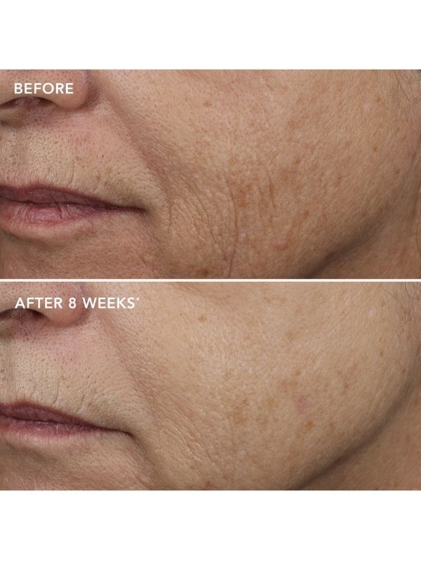 Image Skincare Ageless+ Retinol Overnight Masque 0.5% Retinol Complex