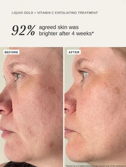 Alpha-H Liquid Gold Exfoliating Treatment with Vitamin C