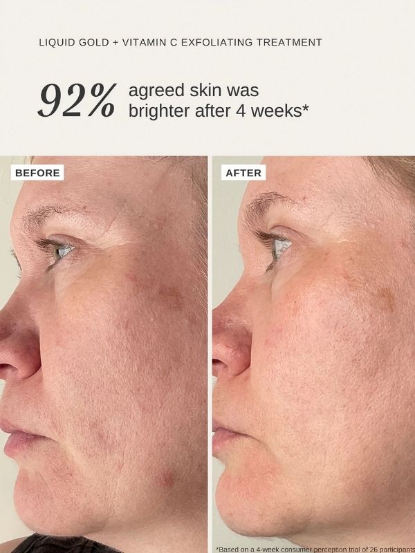 Alpha-H Liquid Gold Exfoliating Treatment with Vitamin C