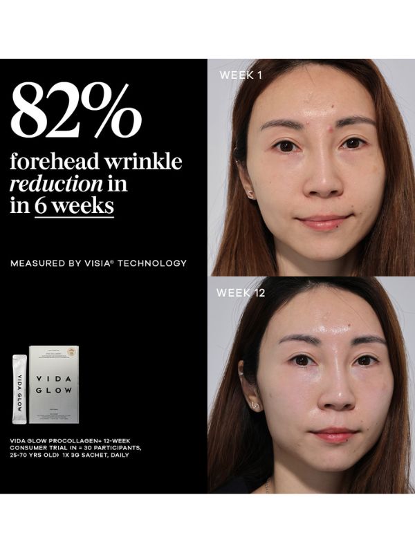 Vida Glow Pro Collagen+ Bonus Set