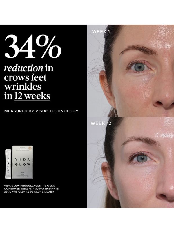 Vida Glow Pro Collagen+ Bonus Set