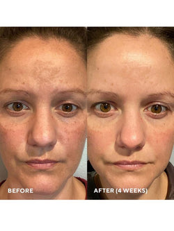 HydroPeptide Firma-Bright