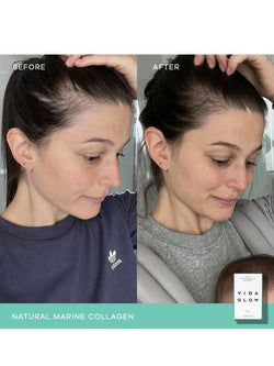 Vida Glow Natural Marine Collagen Peach Sachets