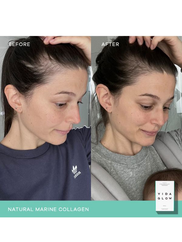 Vida Glow Natural Marine Collagen Mango Sachets