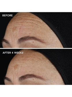 Image Skincare Ageless+ Retinol Pure Liquid Retinol 0.1%