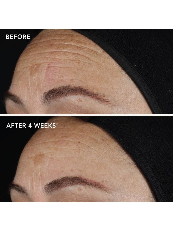 Image Skincare Ageless+ Retinol Pure Liquid Retinol 0.1%