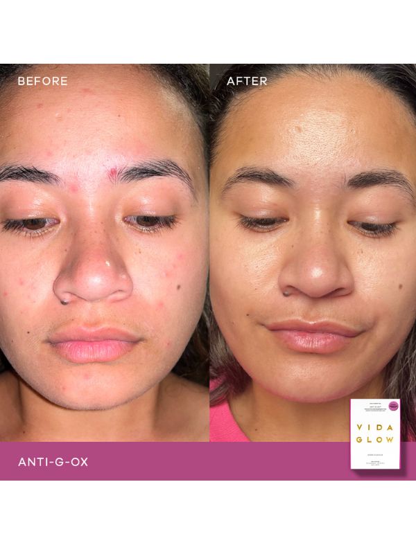 Vida Glow Anti G-Ox Berry