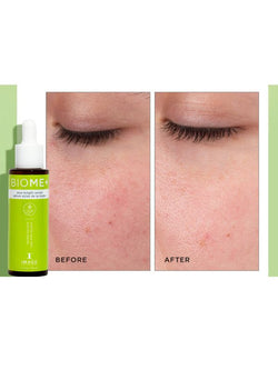 Image Skincare BIOME+ Dew Bright Serum